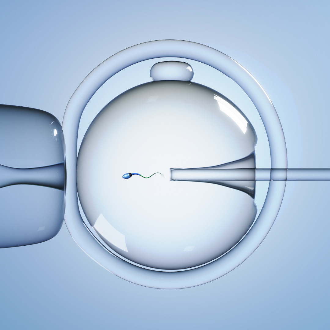 PMA con Inseminazione Intrauterina, FIVET e ICSI - Omniclinics