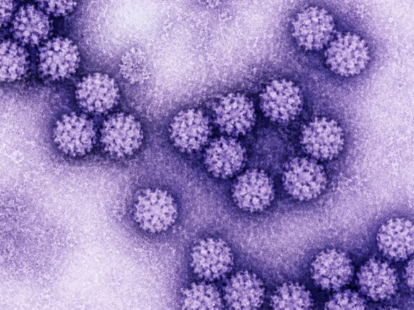 HPV: cos’è, sintomi, prevenzione e perché la diagnosi precoce è fondamentale