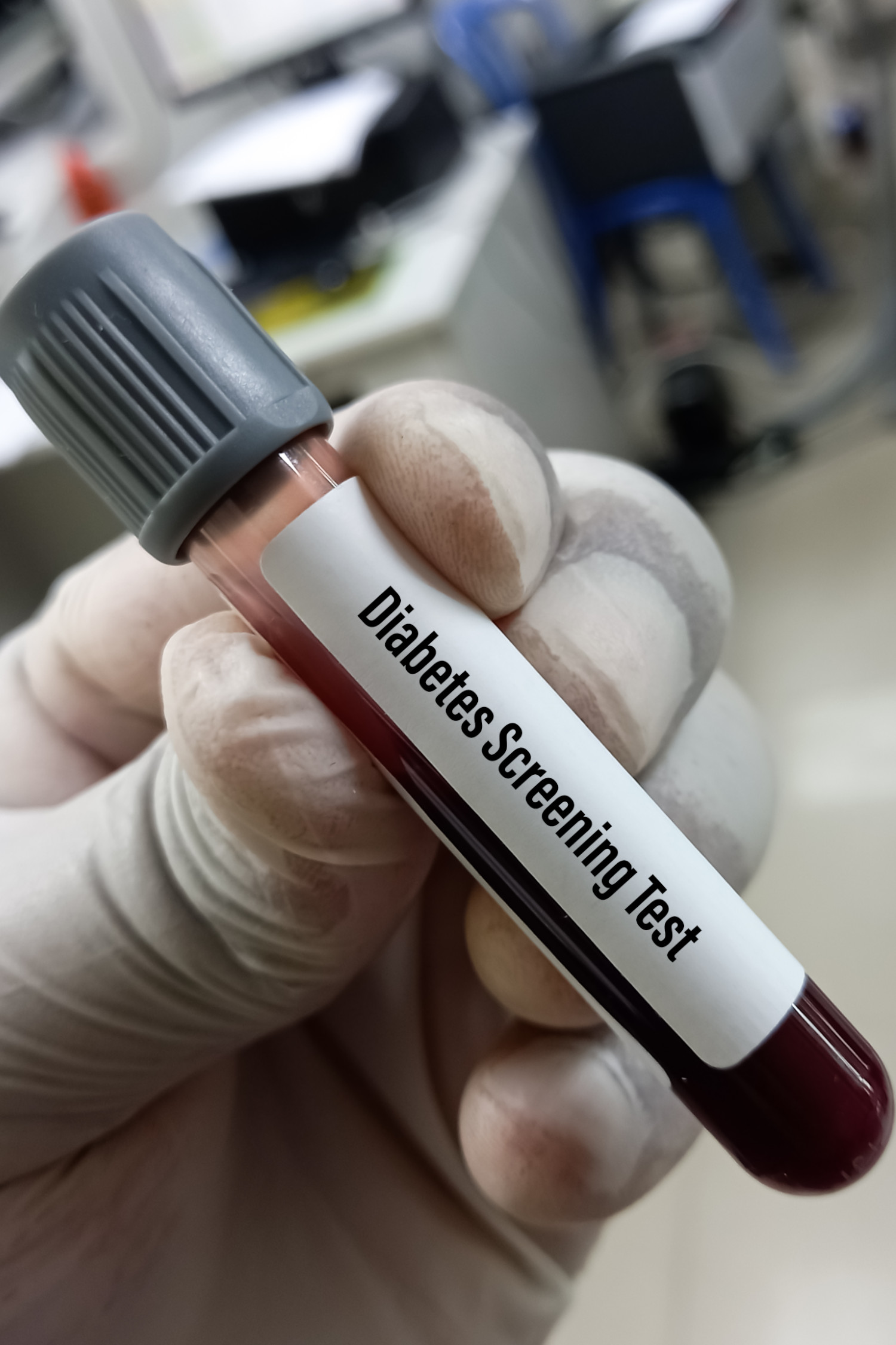 Esami per diabete in gravidanza Bologna - Omniclinics