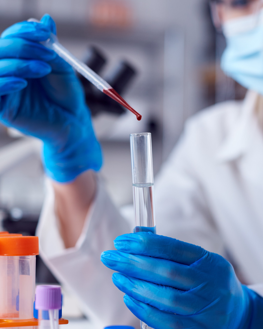 Esami del sangue profilo metabolico Verona - Punto prelievi Omniclinics