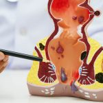Visita proctologica e HPV rettale - Centro Medico Bologna e Verona Omniclinics