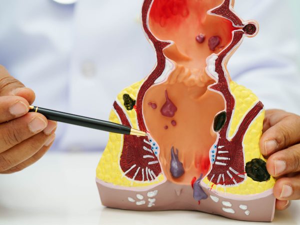 Papillomavirus rettale e visita proctologica: un approccio multidisciplinare