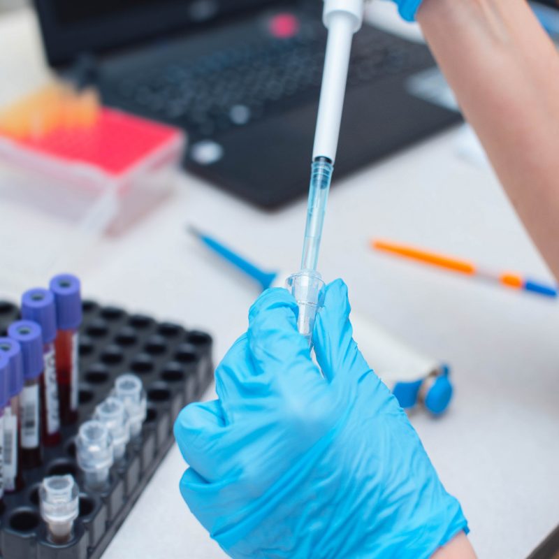 Amniocentesi a Bologna e Verona presso Centro Medico Omniclinics - Esami di Diagnosi Prenatale