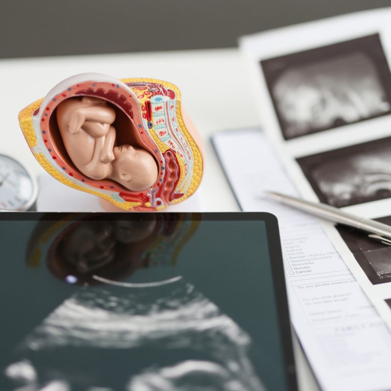 Esame di Amniocentesi per Sindrome di Down, anomalie cromosomiche e malattie genetiche - Centro Medico Bologna Omniclinics