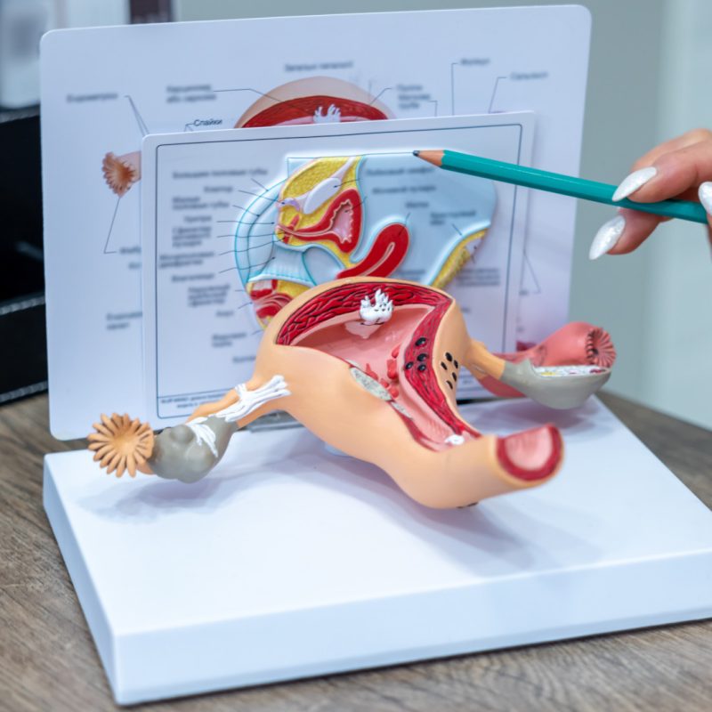 Chirurgia Ginecologica in Omniclinics: trattamenti lesioni da HPV, prolasso uterino, vaporizzazione ginecologica