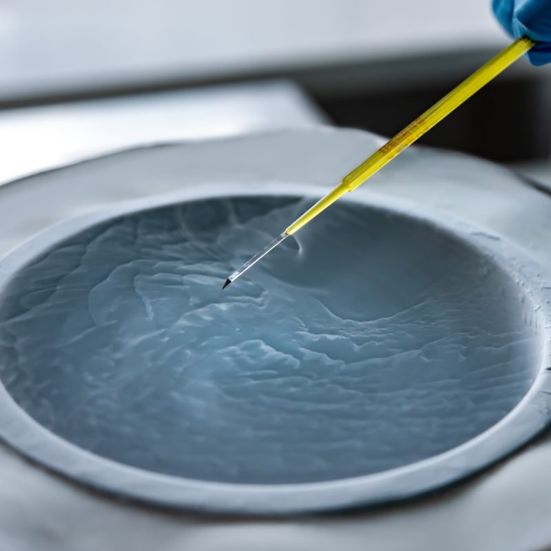 Crioconservazione ovociti Bologna - Omniclinics