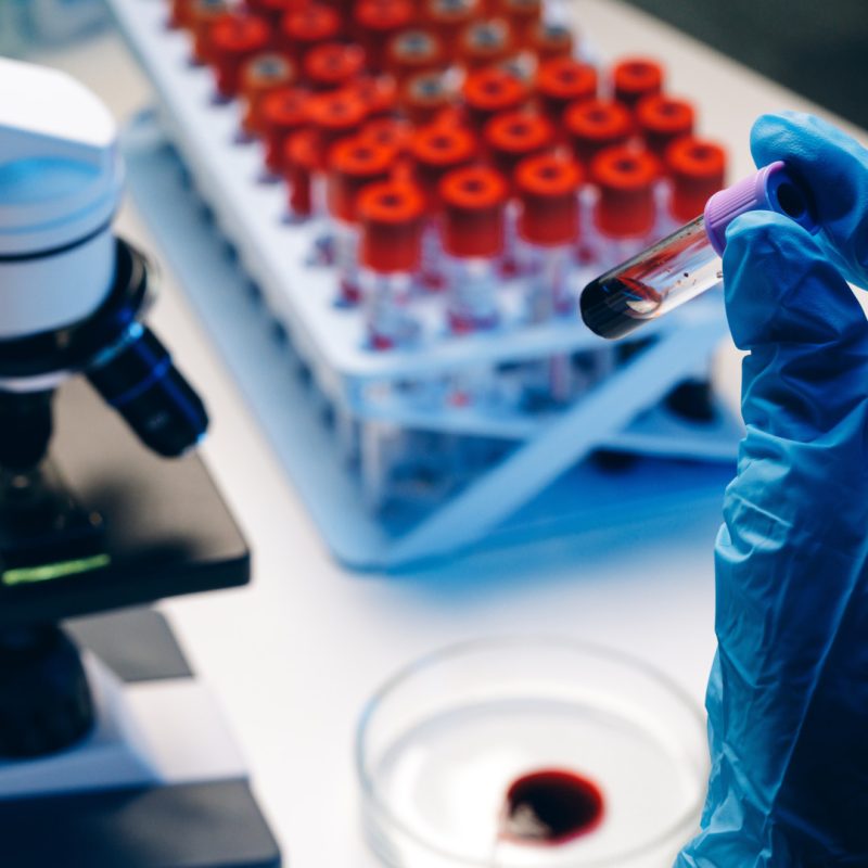 Esami del sangue per Test Combinato di Secondo Livello a Verona - Centro Medico Omniclinics