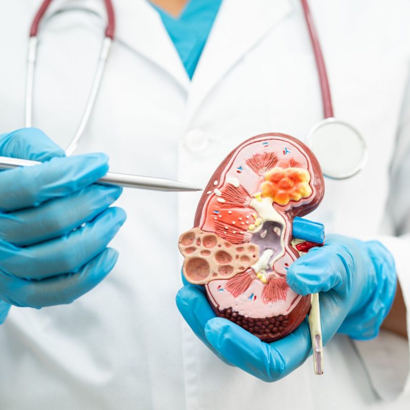 nefrologia-omniclinics